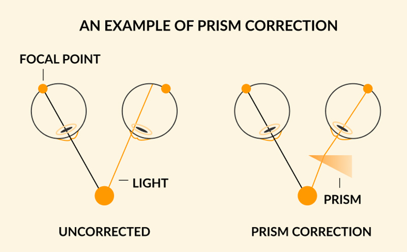 What are prism glasses?